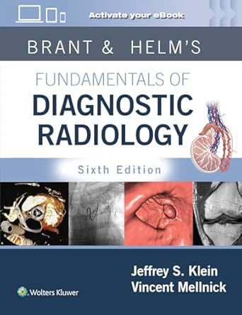 Brant & Helms' Fundamentals of Diagnostic Radiology: Print + eBook with Multimedia 