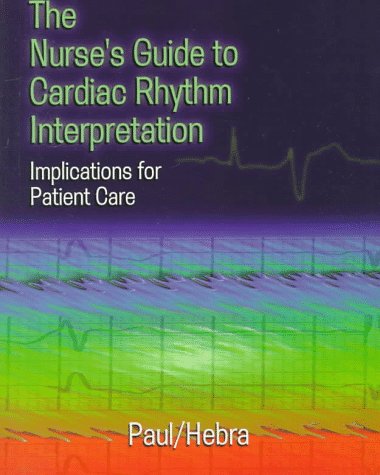 The Nurse's Guide to Cardiac Rhythm Interpratation Implications for Patiet Care