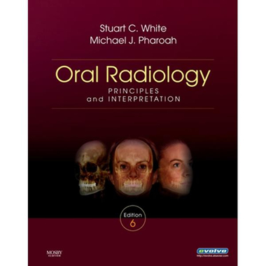 Oral Radiology Principle and Interpretation