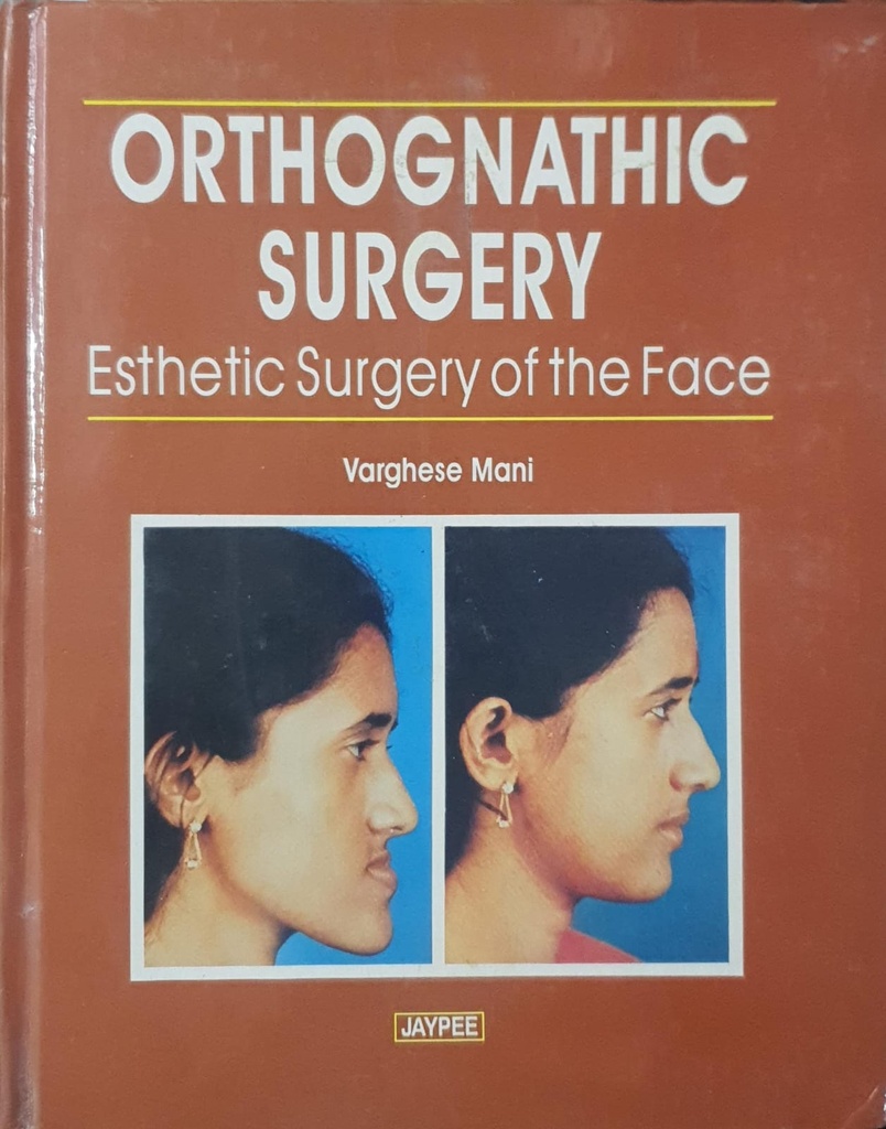 Orthognathic Surgery Esthetic Surgery of the Face