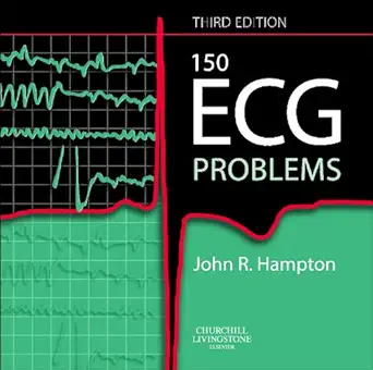 [9780443068225] 150 ECG Problems 