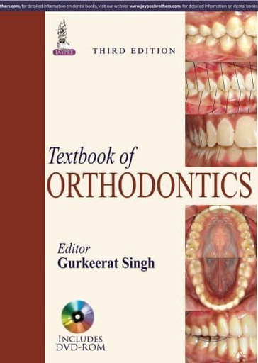 [9788184480801] Textbook of Orthodontics