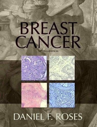 [9780443066344] Breast Cancer