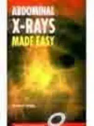 [9780443062063] Abdominal X-Rays Made Easy