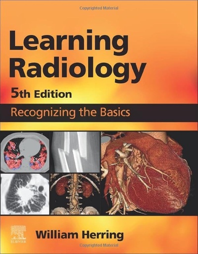 [9780323878173] [PRINT] Learning Radiology: Recognizing the Basics 